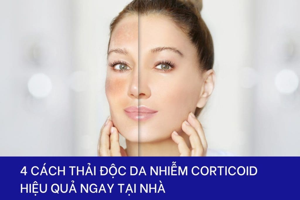 4 cách thải độc da nhiễm corticoid tại nhà hiệu quả