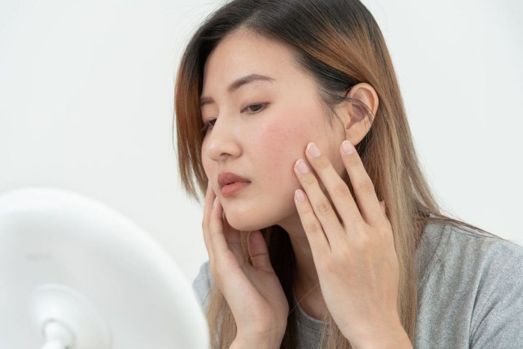 Nguyên nhân làn da bị hư tổn