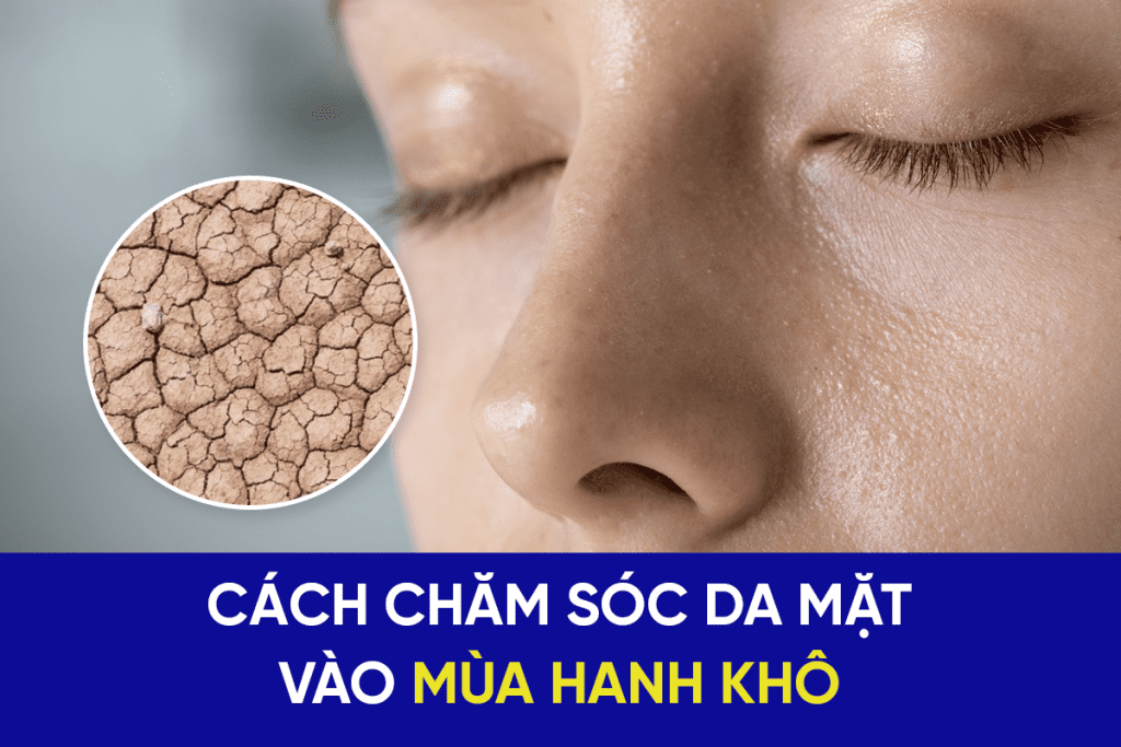 Cách chăm sóc da mặt vào mùa hanh khô