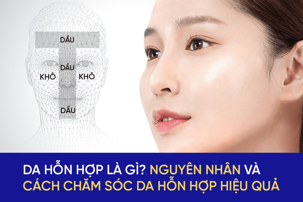 Da hỗn hợp là gì và cách chăm sóc da hỗn hợp