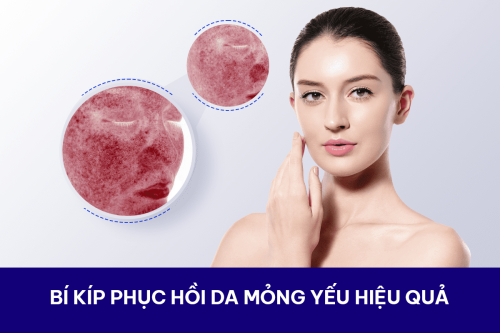 Cách phục hồi da mỏng yếu tại nhà