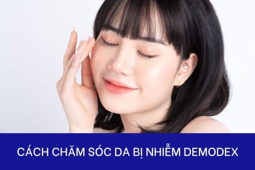Cách chăm sóc da bị Demodex