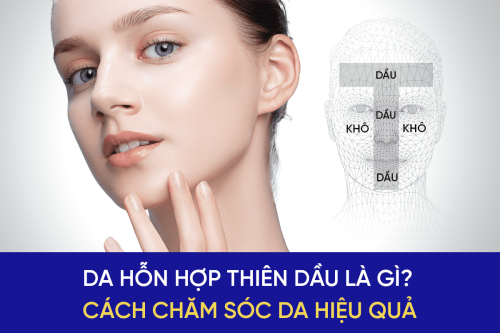 da-hỗn-hợp-thiên-dầu