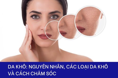 Nguyên nhân và cách chăm sóc da khô