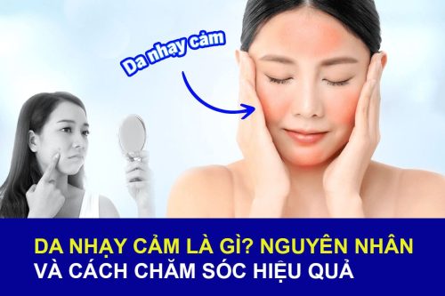 Da nhạy cảm là gì? Nguyên nhân và cách chăm sóc hiệu quả