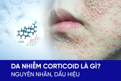 Nguyên nhân da nhiễm corticoid, dấu hiệu nhận biết và cách phục hồi