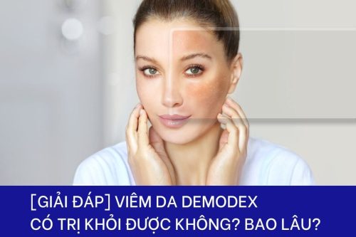 Viêm da Demodex có chữa khỏi không và mất bao lâu